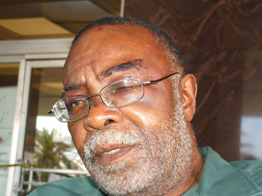 Robert Davis displays his wounds minutes after his release from Camp Amtrak.